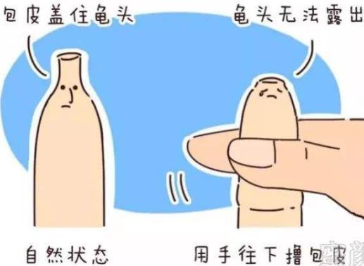 割包皮适应症状是什么?