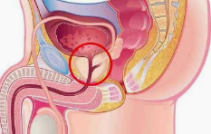前列腺家庭按摩法都有哪些