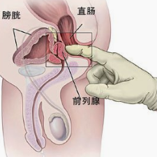 患有前列腺炎应该吃什么食物