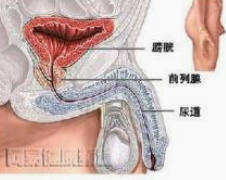 吃哪些水果对患有前列腺炎有帮助